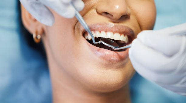 Best Emergency Wisdom Teeth Removal in Litchfield, IL