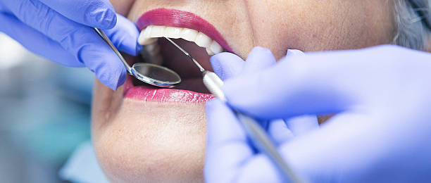 Best Emergency Denture Repair in Litchfield, IL